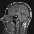 MRI scan of my brain - looks pretty big, um?