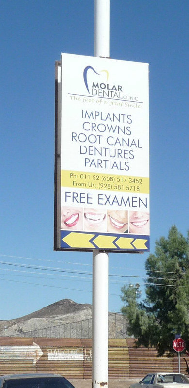 need implants? in Algodones Mexico
