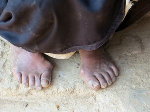 Elderly woman's leathery feet in Zhanglang