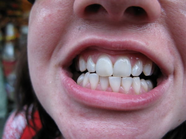 Mons Shiny White Teeth