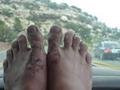 Rich's feet