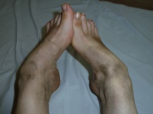 Dirty Delhi feet