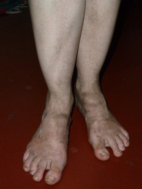 Dirty Kolkata feet
