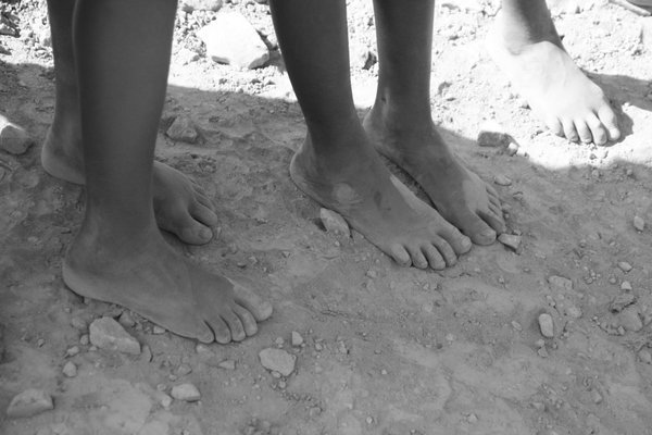 very rural area, the kids rarely have shoes