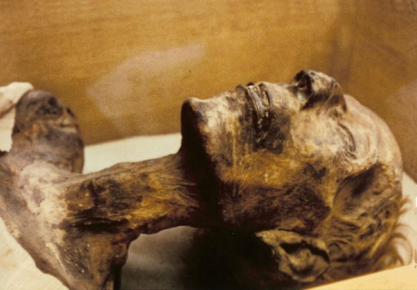 Mummy of Rameses II