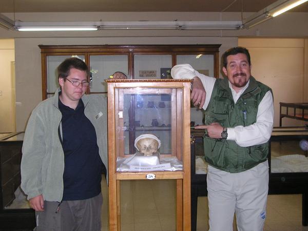 Julio, Noah, And A Deformed Indian Skull