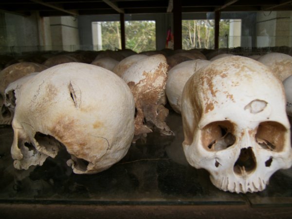 Skulls dug up at the Killing Fields