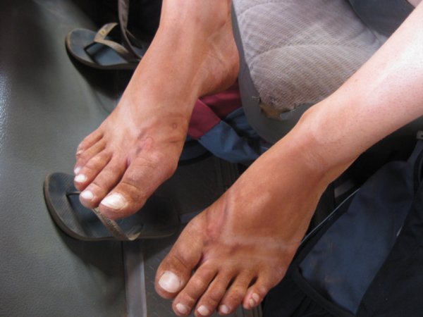 82. Sif's feet after walking around Uluru