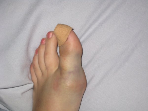 my toe!!