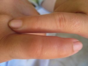 my finger