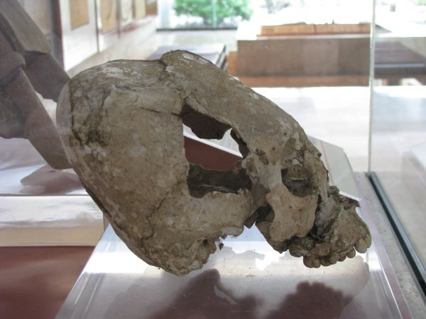 Deformed skull