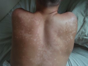 My back after Cayos Cuchinos