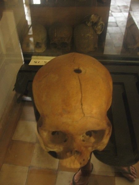 Many of the skulls have a single bullet hole to the top of the head